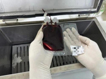 跨越三年的生命自救，自体脐血救治再障患儿